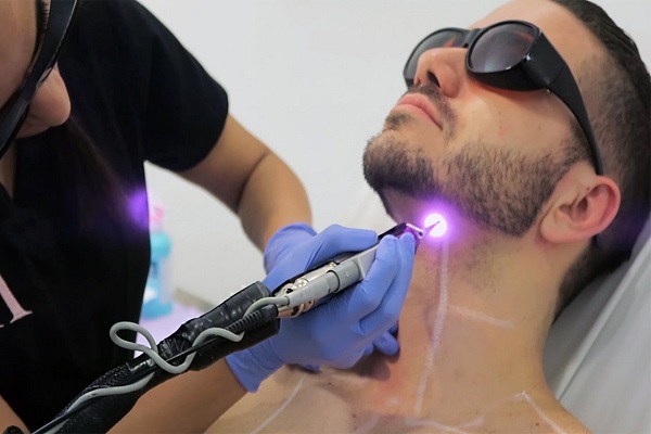 Laser Hair removal dubai